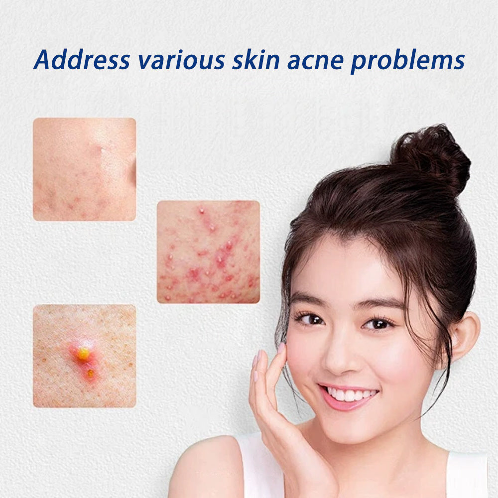 Skin acne care patch