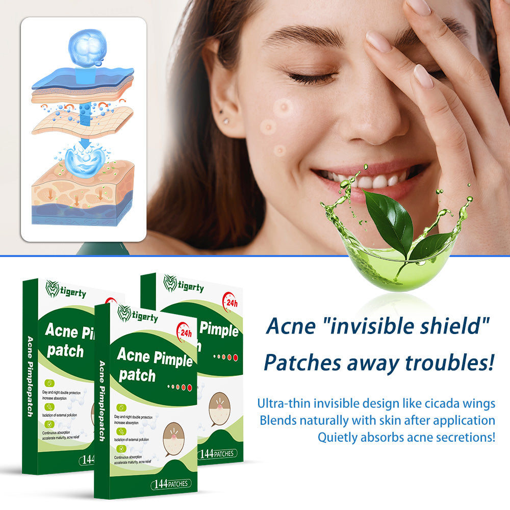 Skin acne care patch