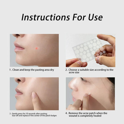 Skin acne care patch