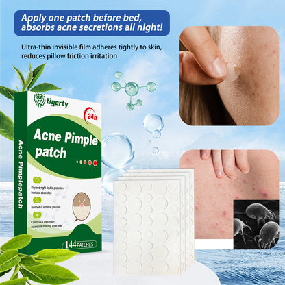 Skin acne care patch